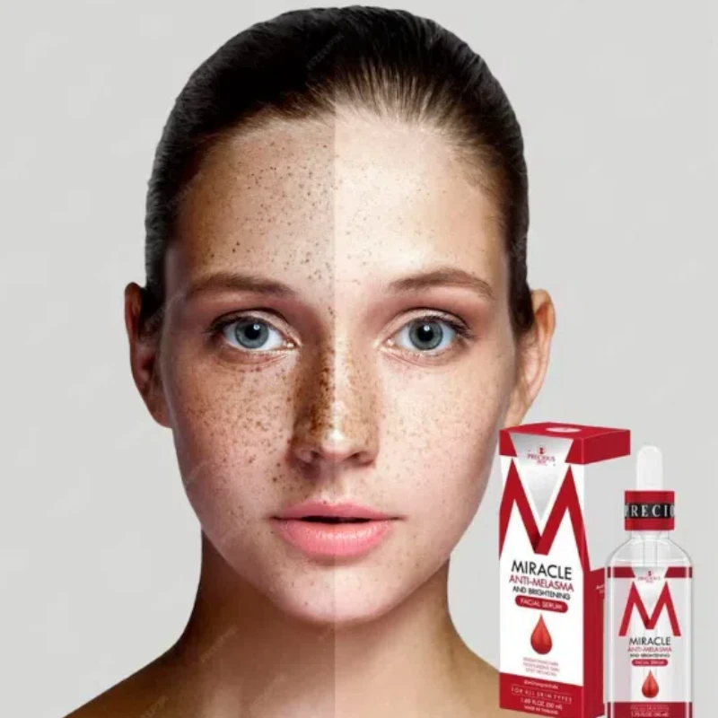 Precious Skin Miracle Anti Melasma Whitening Serum - 50ml