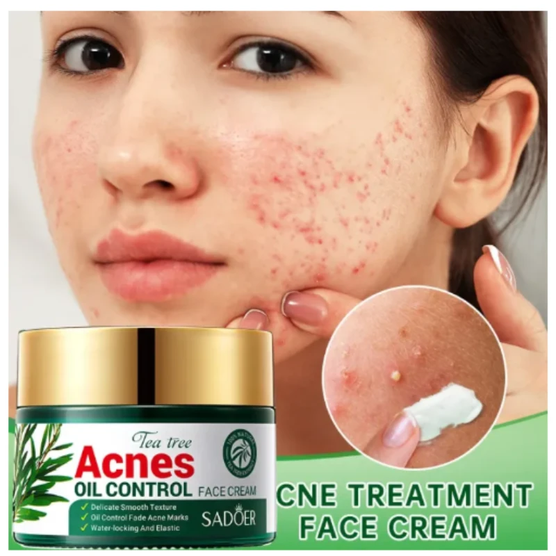 SADOER Tea Tree Oil Face Acne Treatment Moisturizer Scar Cream-50gm