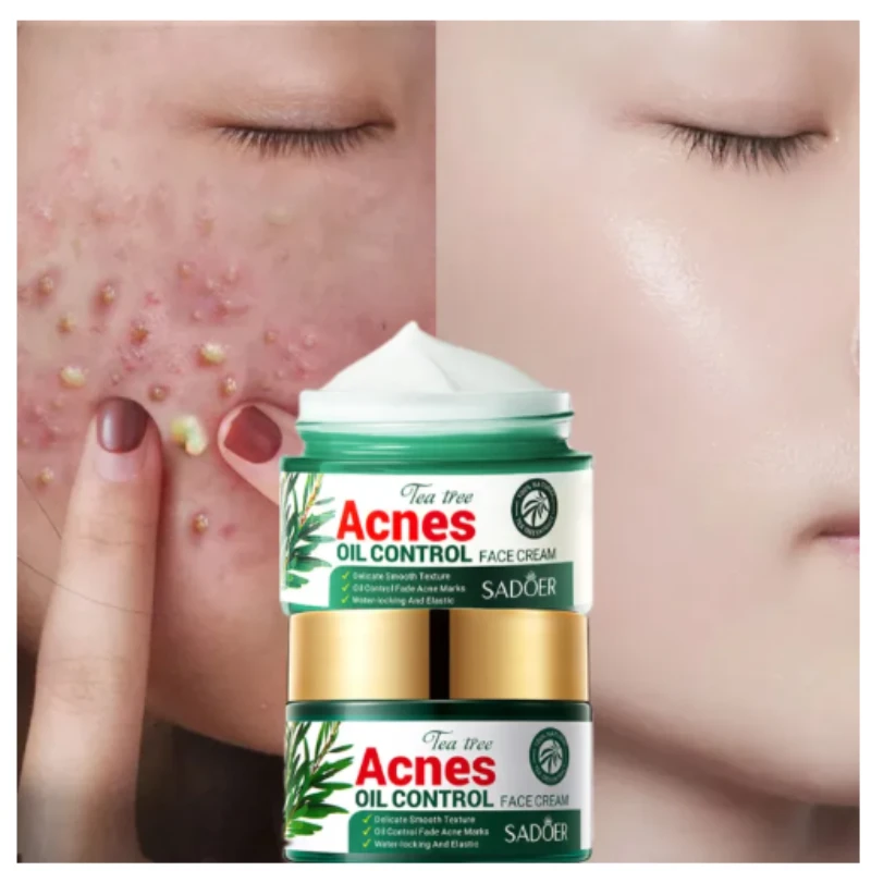 SADOER Tea Tree Oil Face Acne Treatment Moisturizer Scar Cream-50gm - Image 3