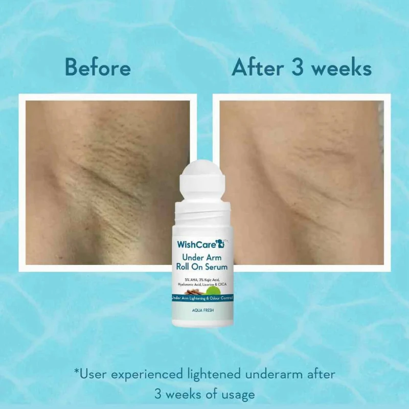 WishCare Under Arm Roll On Serum 50ml