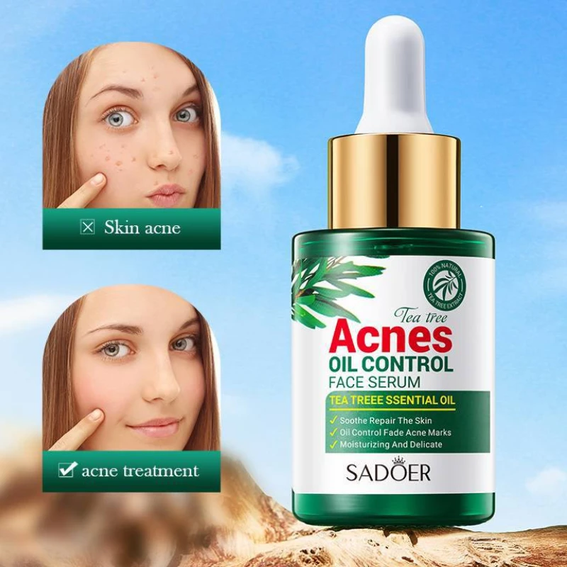 Sadoer Tea Tree Oil Control Anti-Acne Serum Essence -30ml