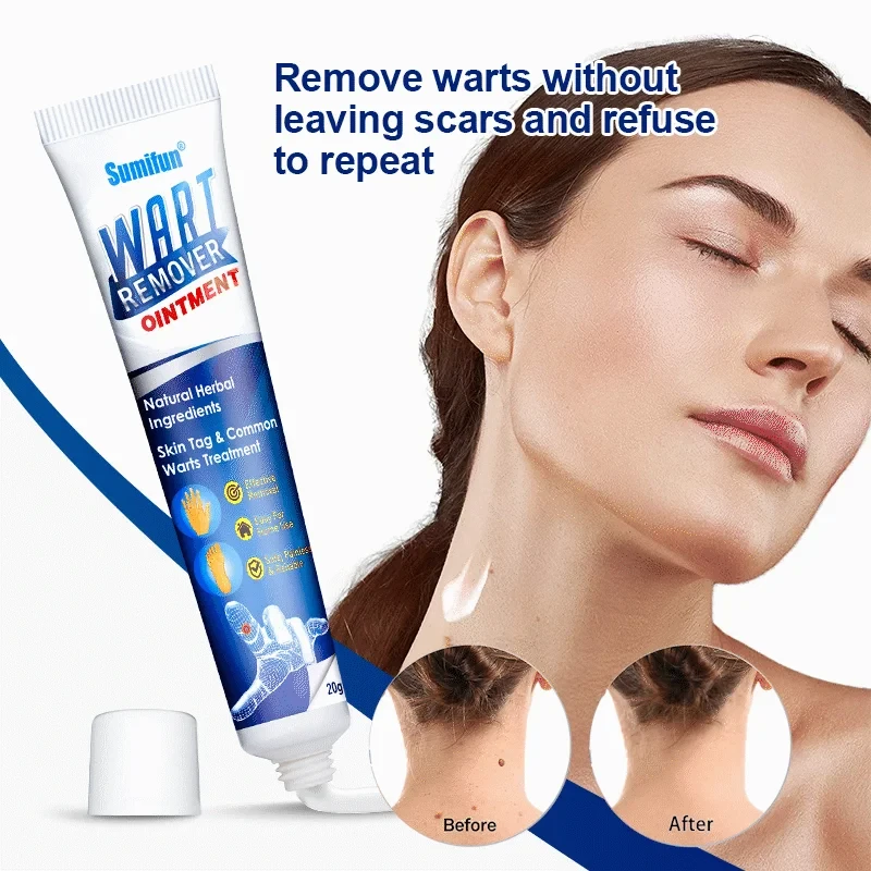Wart Remover Ointment 20gm - Image 3