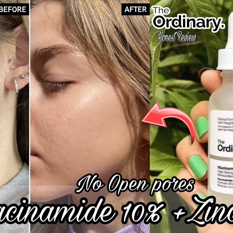 𝐓𝐡𝐞 𝐎𝐫𝐝𝐢𝐧𝐚𝐫𝐲 𝐍𝐢𝐚𝐜𝐢𝐧𝐚𝐦𝐢𝐝𝐞 𝟏𝟎% + 𝐙𝐢𝐧𝐜 𝟏%(30ml) - Image 4