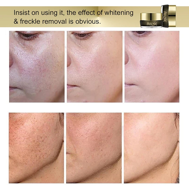 Ailke 8K Plus 10X Dark Spot Whitening Night Cream -25g - Image 4