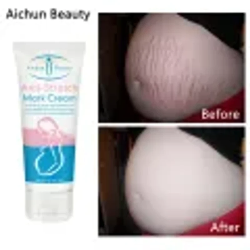 Anti Stretch Mark Cream scar cream Pregnancy Scar Removal Repair Cream Stretch Marks Whitening Fades Stretch Marks Repair Scar Slack Line Skin Care - Image 3