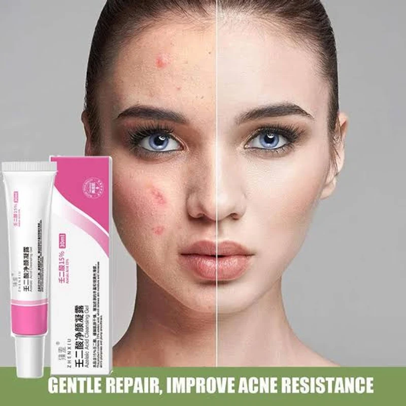 Azelaic Acid Cleansing Gel & Salicylic Acid Pore Refining Cream