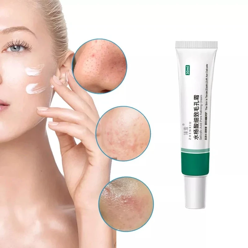 Azelaic Acid Cleansing Gel & Salicylic Acid Pore Refining Cream - Image 3