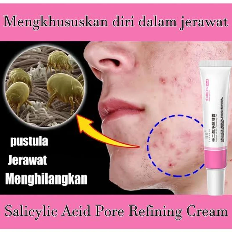 Azelaic Acid Cleansing Gel & Salicylic Acid Pore Refining Cream - Image 4