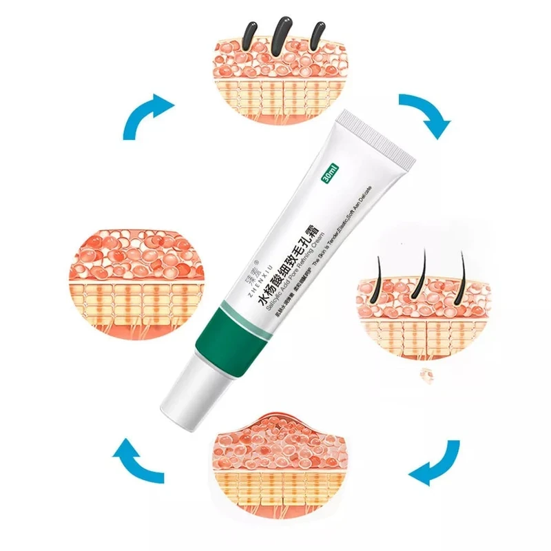 Azelaic Acid Cleansing Gel & Salicylic Acid Pore Refining Cream - Image 8