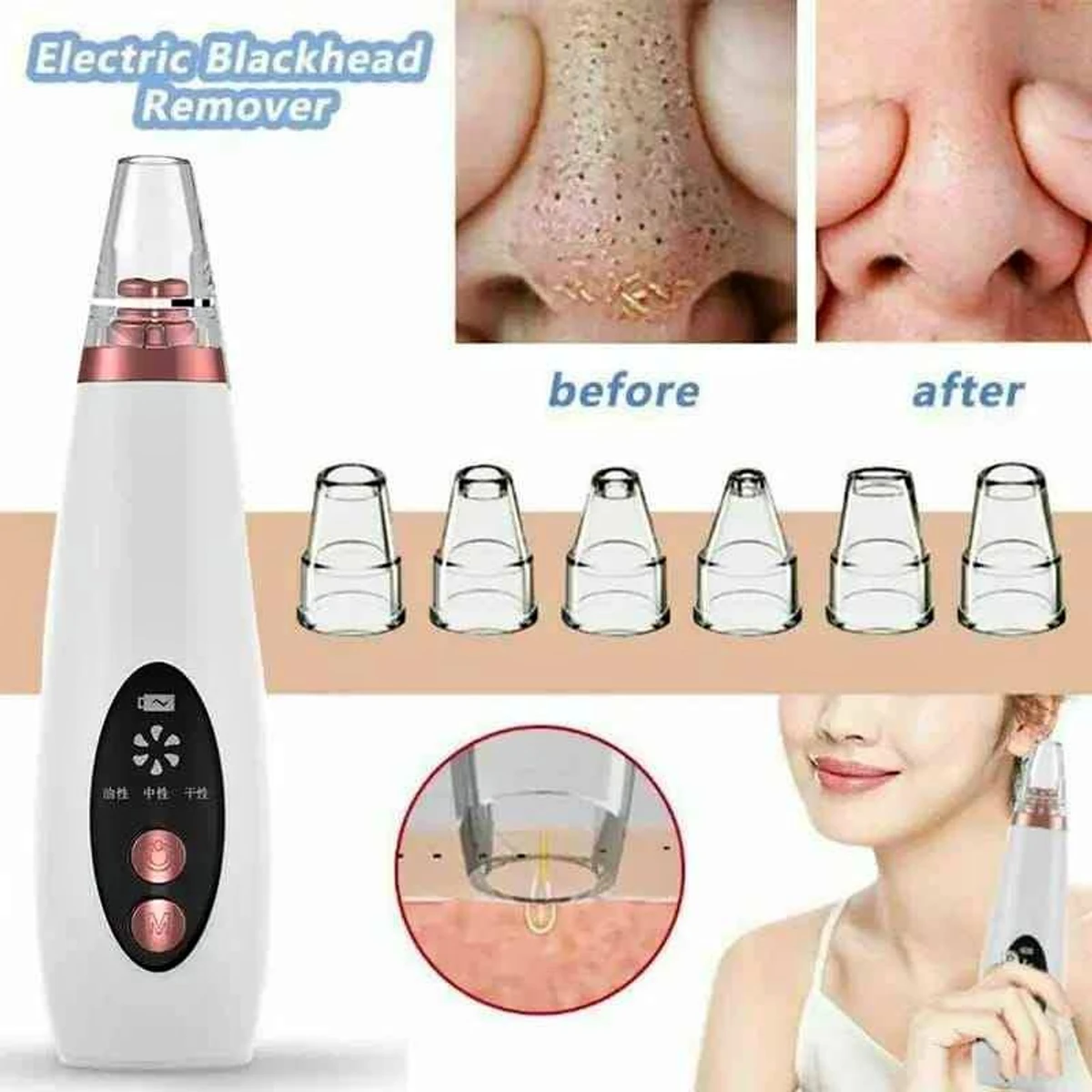 blackhead Remover - Thumbnail 5