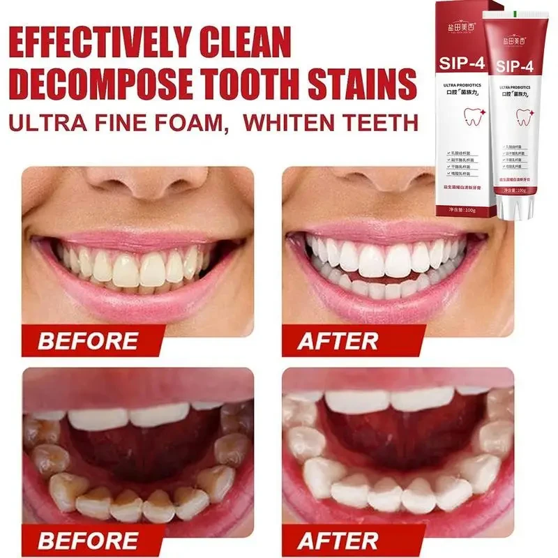 SP-4 Probiotic Whitening Toothpaste - Image 3