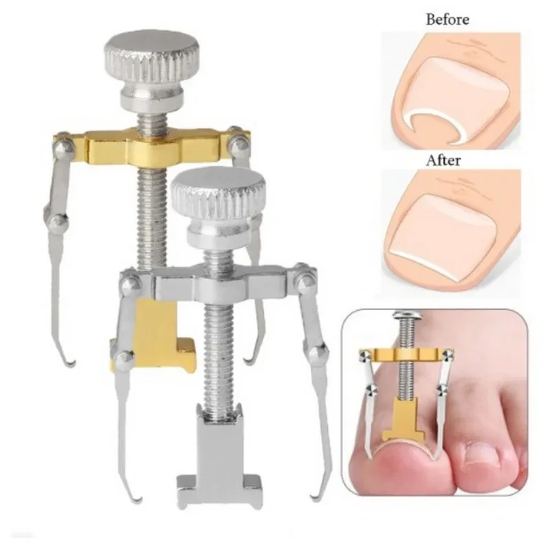 Nail Recover Correction Tool