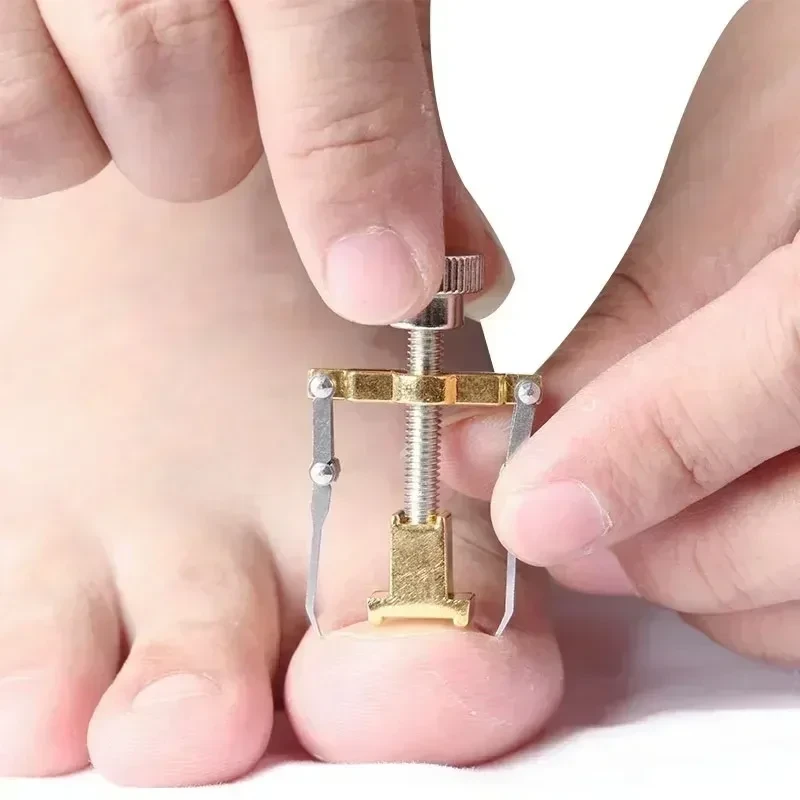 Nail Recover Correction Tool