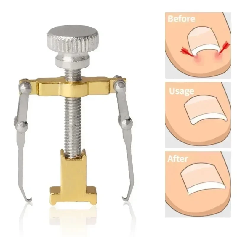 Nail Recover Correction Tool - Image 4