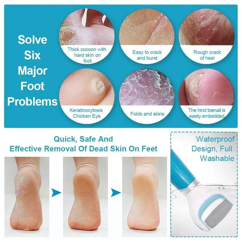 Foot Heel Scholl Pedi Spin