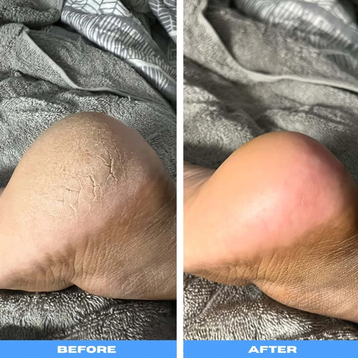 পেডিকিউর ফুট কেয়ার - Image 3