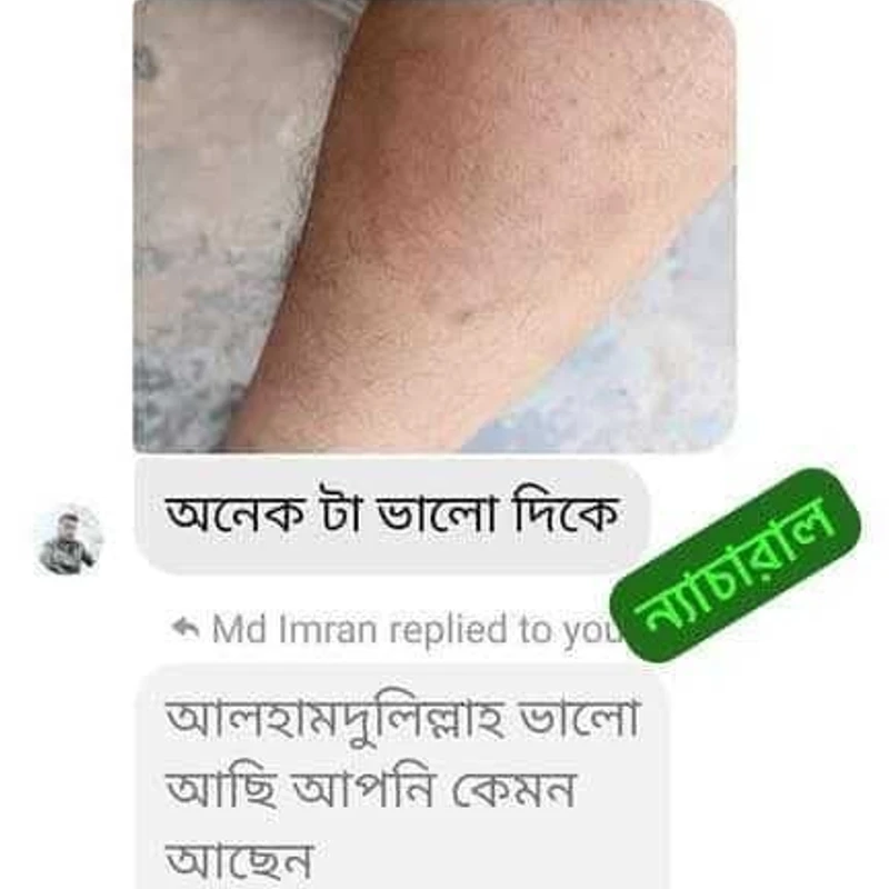 Allergy care plus - Image 3