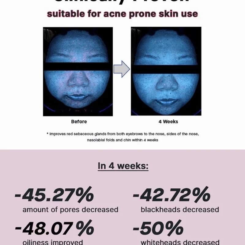 COSRX The Niacinamide 15 Serum - Image 7