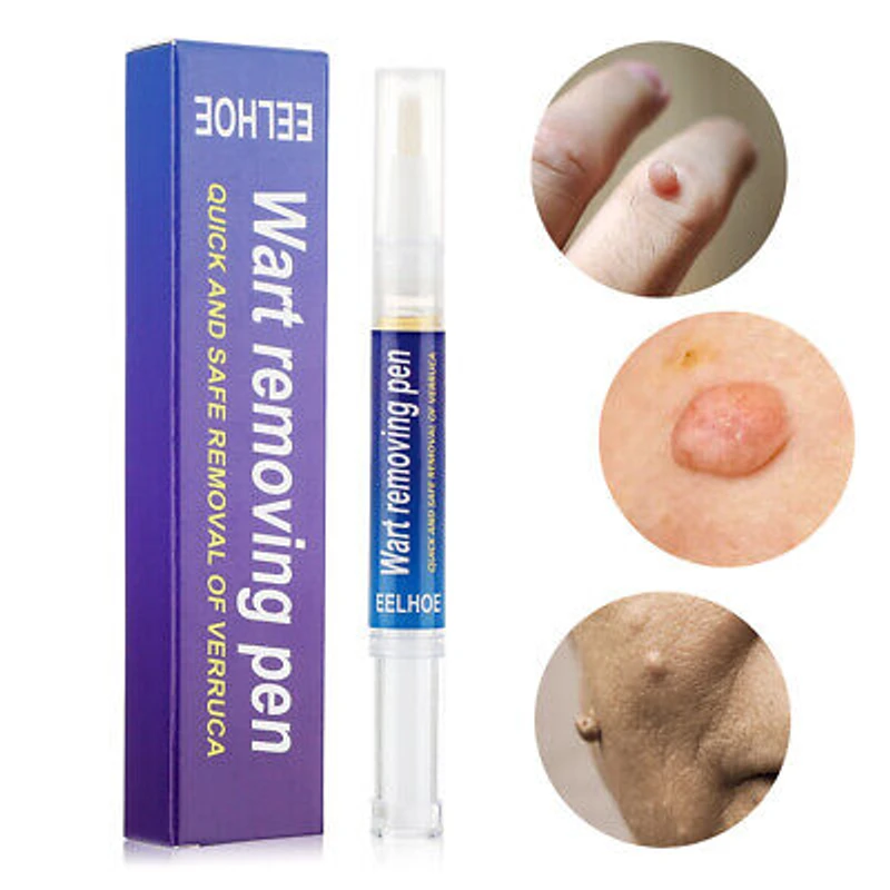 Wart Remover Skin Tag Cream