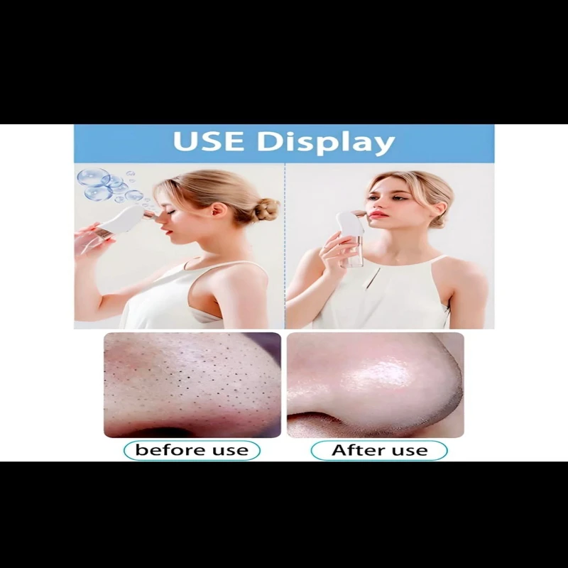 Rechargeable Blackhead Remover