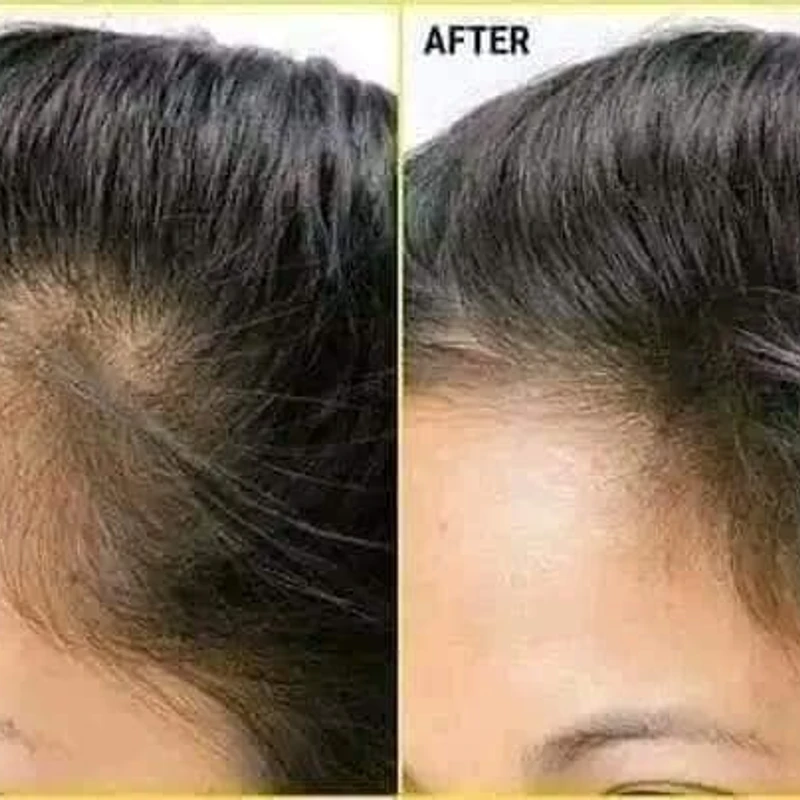 Super Long Hair Capsule Vitami E  Jajoba Oil - Image 4