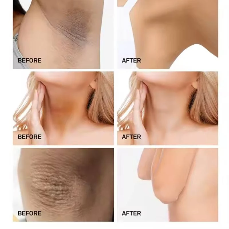 BEAUTE 3D Underarm Whitening Cure Cream - Image 3