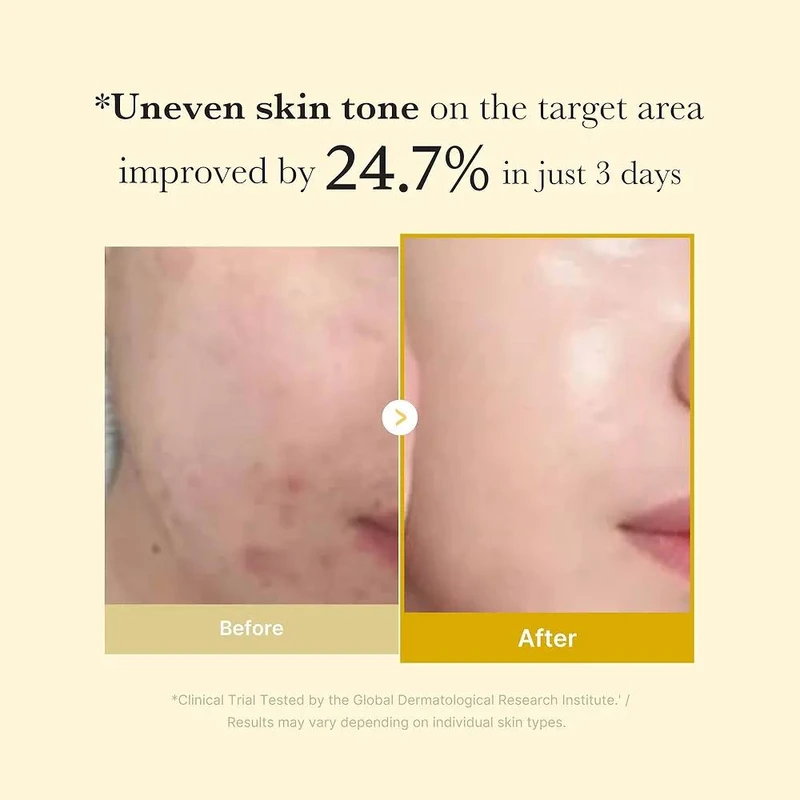 Medicube Kojic Acid Turmeric Night Wrapping Mask - Image 3