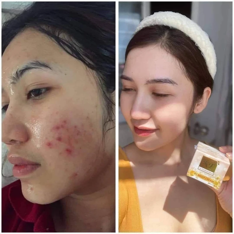 KT Gold Plus Pearl Night Cream - Image 3